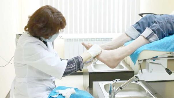 Dermatológ lieči plesne nechtov na nohách